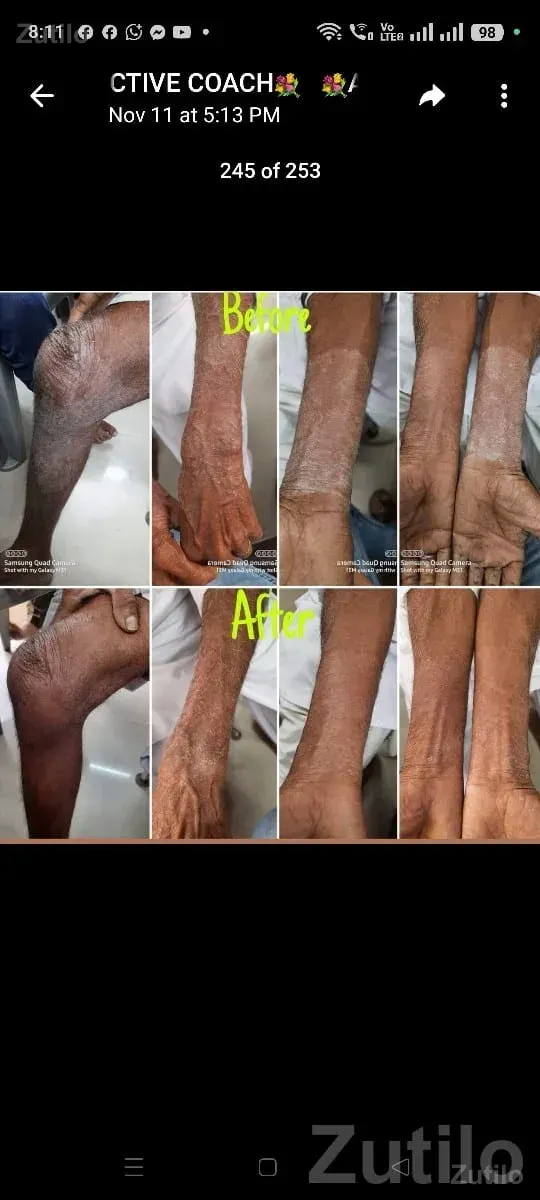Weight Loss & Health Improvement Product - Beautician & Salon - Mendarda - Image 3